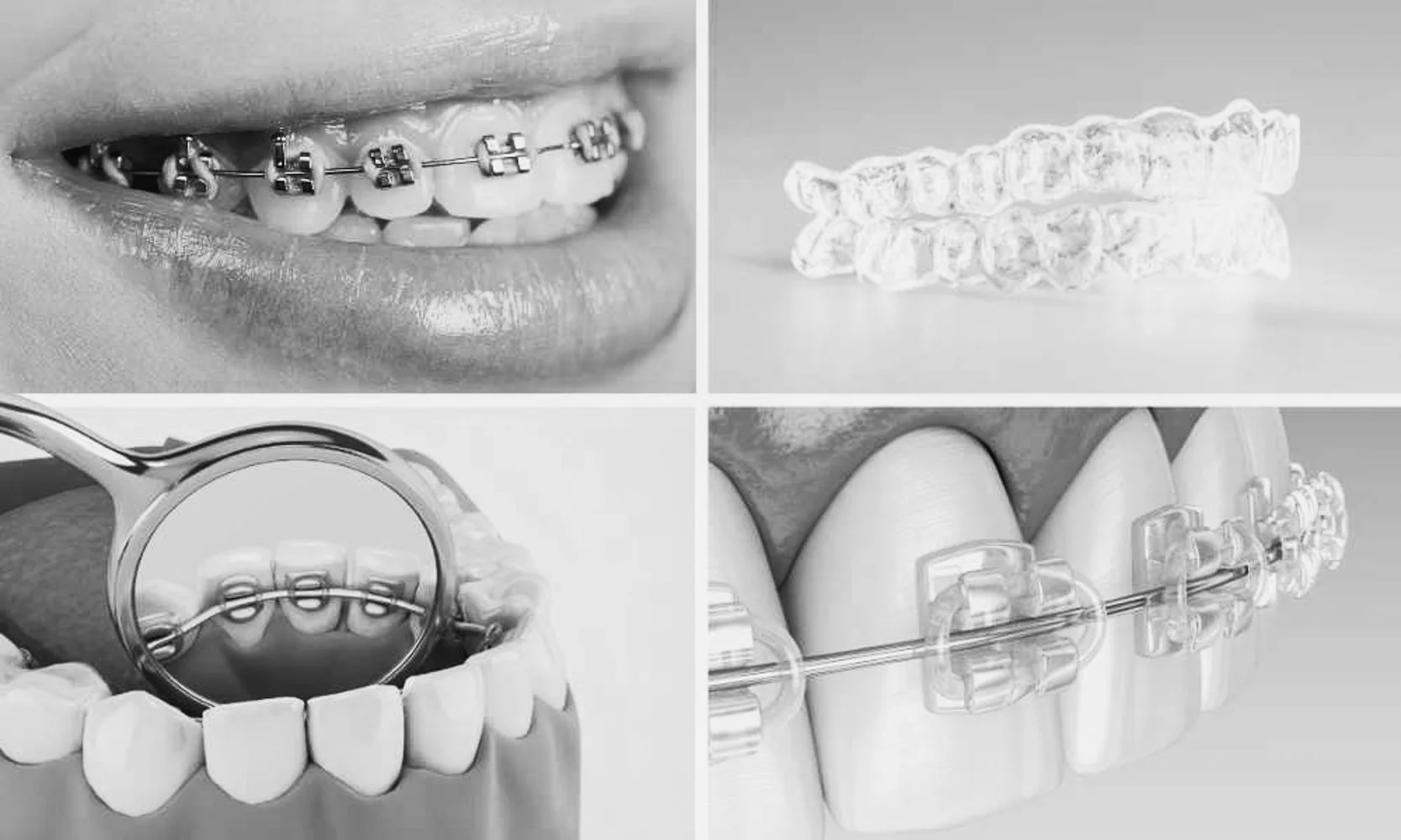 Er gjennomsiktige seler like effektive som tradisjonelle seler?