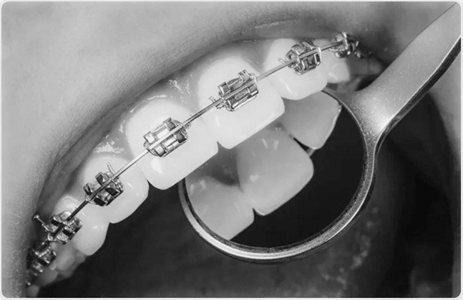 Er det noen unike hensyn å ta når man skaffer seg tannregulering i Oslo?