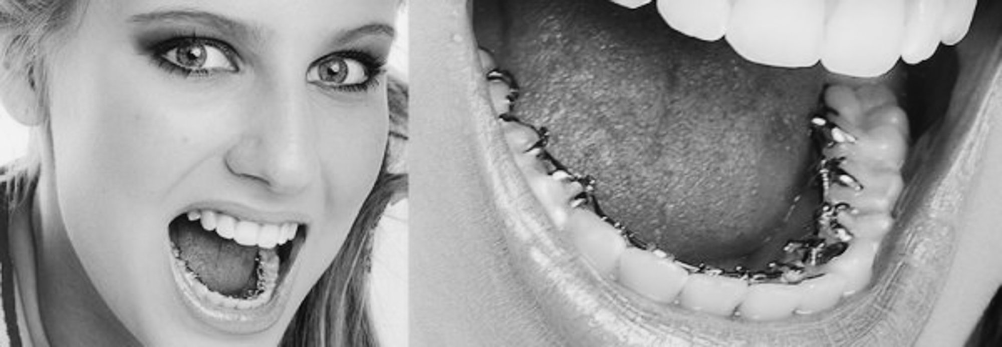 Hvordan skiller inkognitoseler seg fra andre typer skjulte seler?