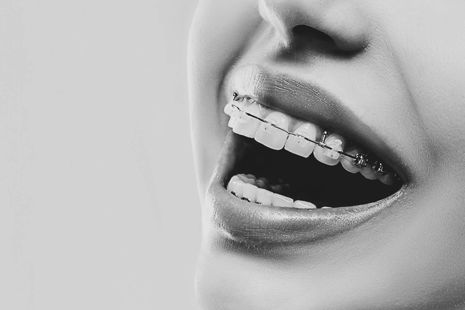 Tannlege Regulering: Din Veiledning til Tannreguleringsbehandling