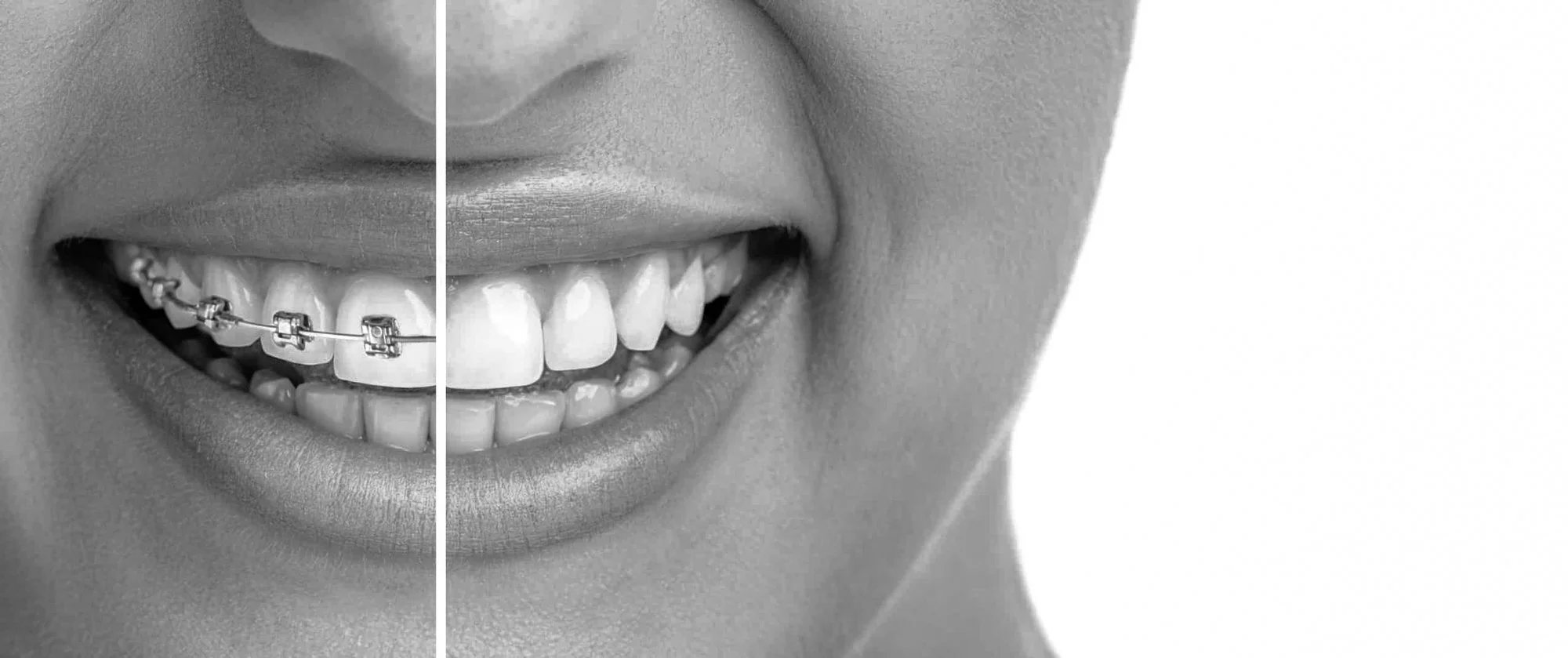 Tannregulering Pris Voksne: Hva Du Kan Forvente