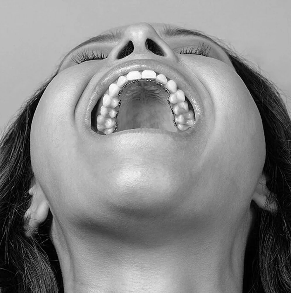 Hvor kan jeg finne en klinikk som tilbyr incognito tannregulering i Oslo?