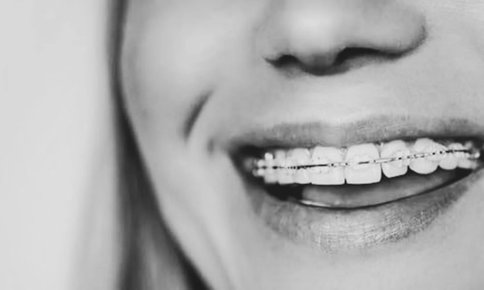 Hvordan bestemmes prisen på tannregulering, og hva kan påvirke kostnaden?