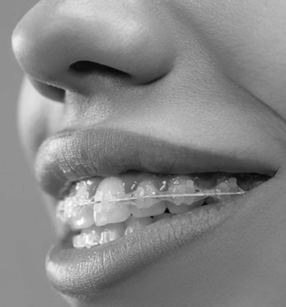 Hvordan bestemmes prisen på tannregulering, og hva kan påvirke kostnaden?