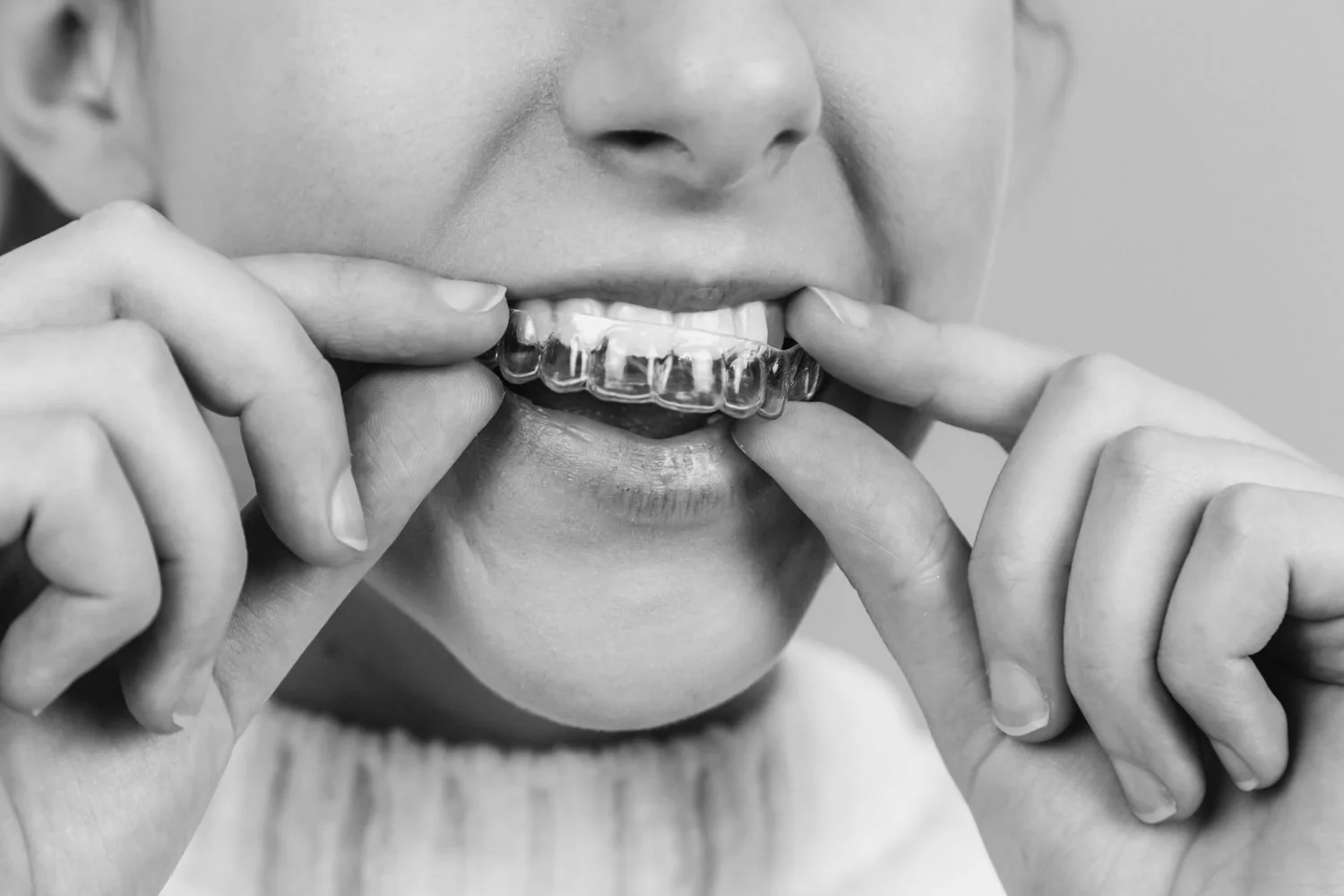 Frognerparken: Oslo's Urban Haven of Art, Nature, and Tranquility