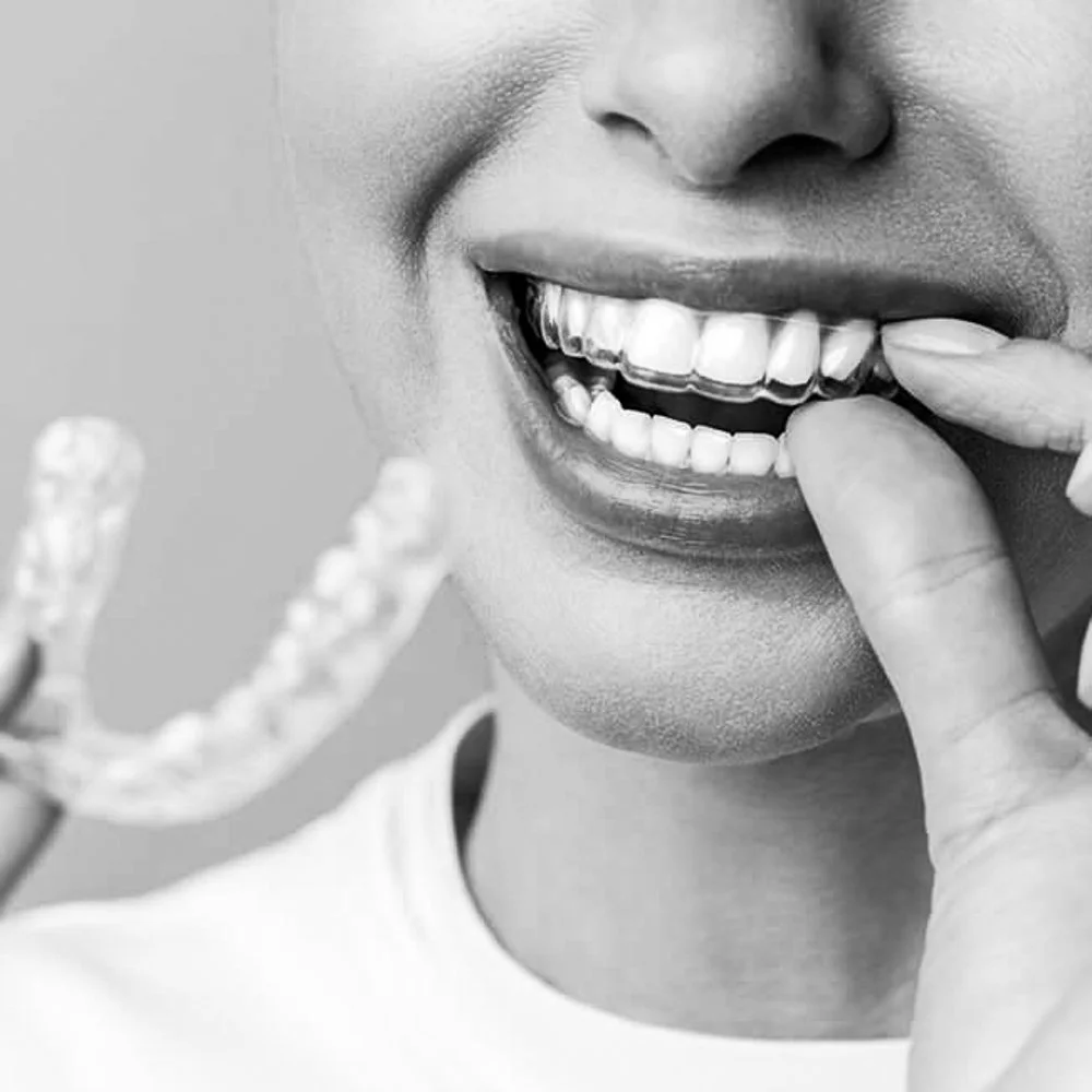 Tannregulering Oslo: Ditt Smilspesialiststed