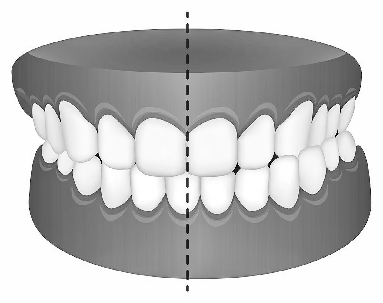 Hva er de vanlige problemene som kryssbitt regulering?