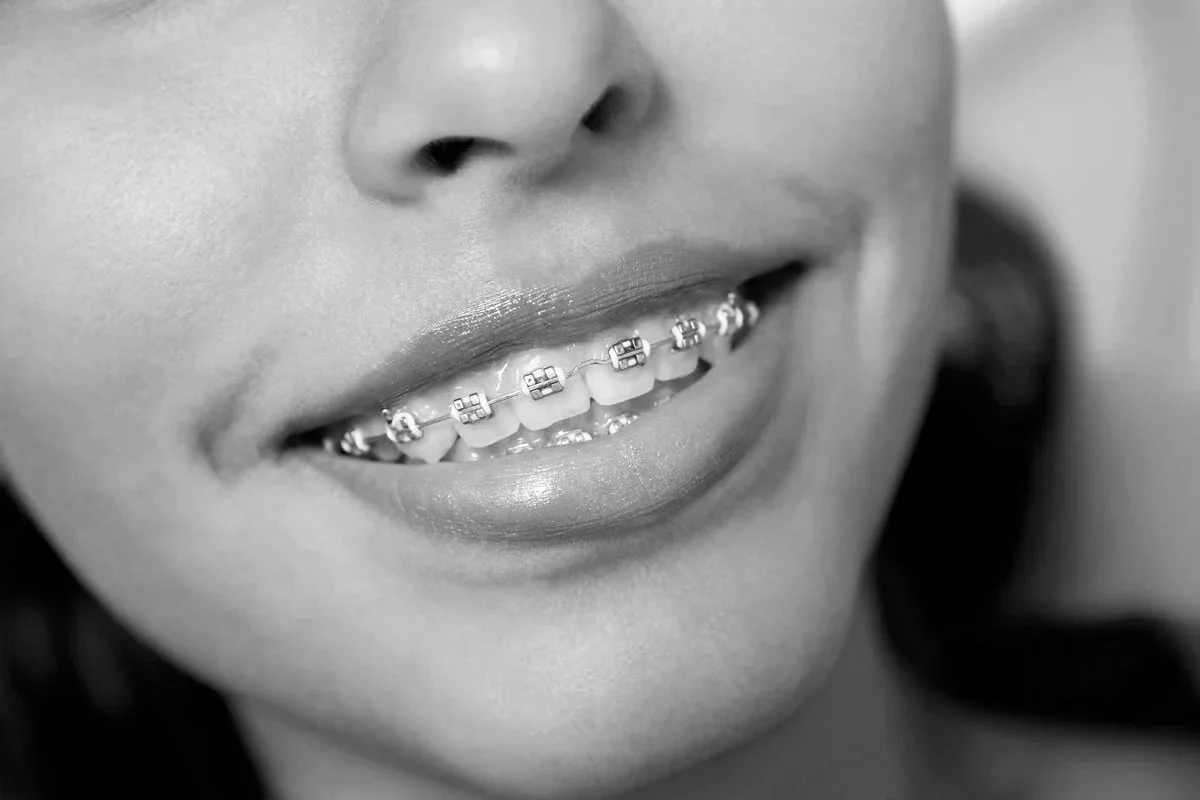 Fast Tannregulering - Hva er Det og Hvilke Alternativer Finnes?