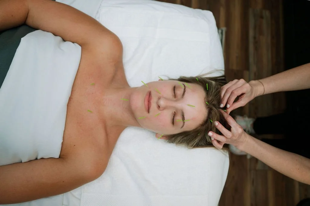 patient receiving facial rejuvenation acupuncture