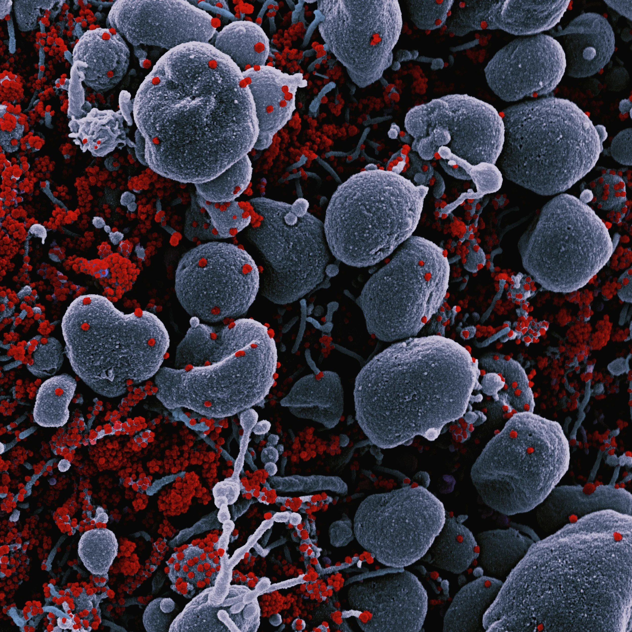Mold and Mycotoxin Illness: Commonly Missed Symptoms, Causes and How to Heal 