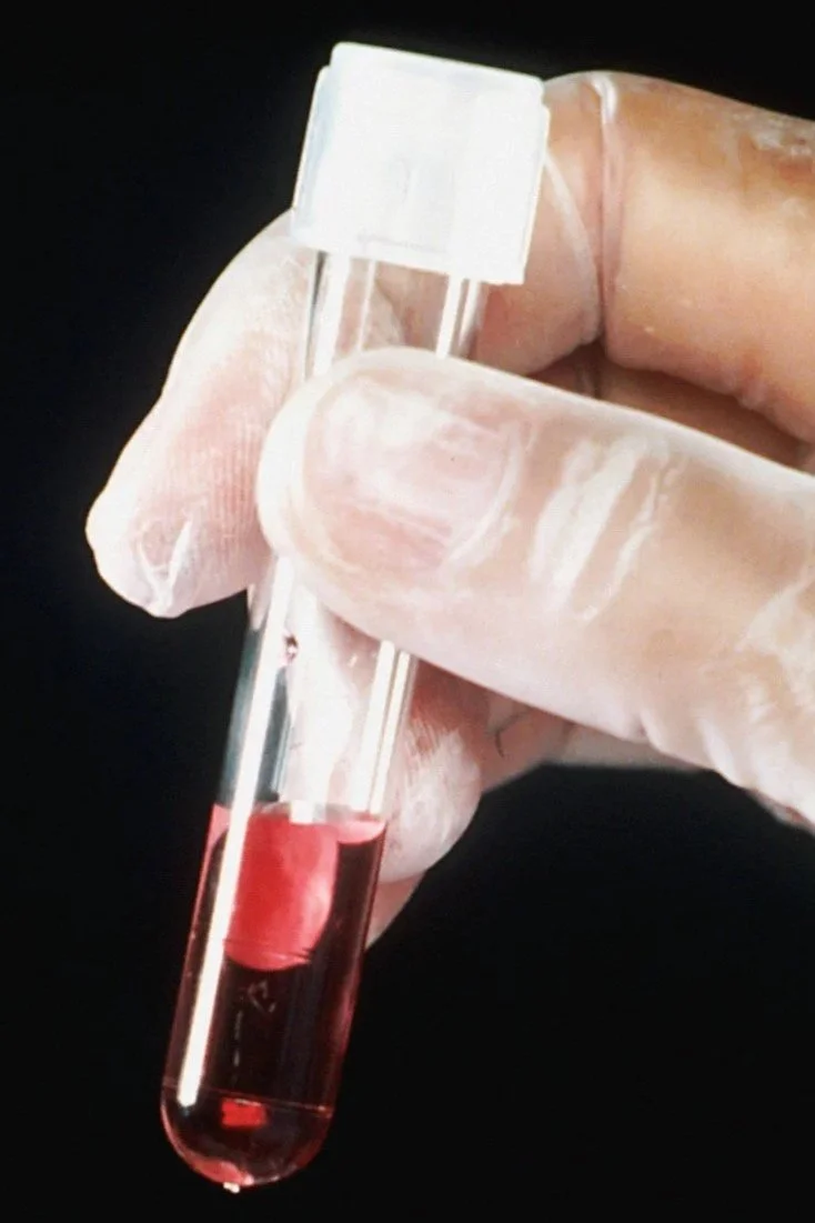 Telehealth naturopathic and functional medicine care for fertility, hormone balance, chronic illness and Lyme disease. Serving patients across California and New Hampshire. Functional medical labs.