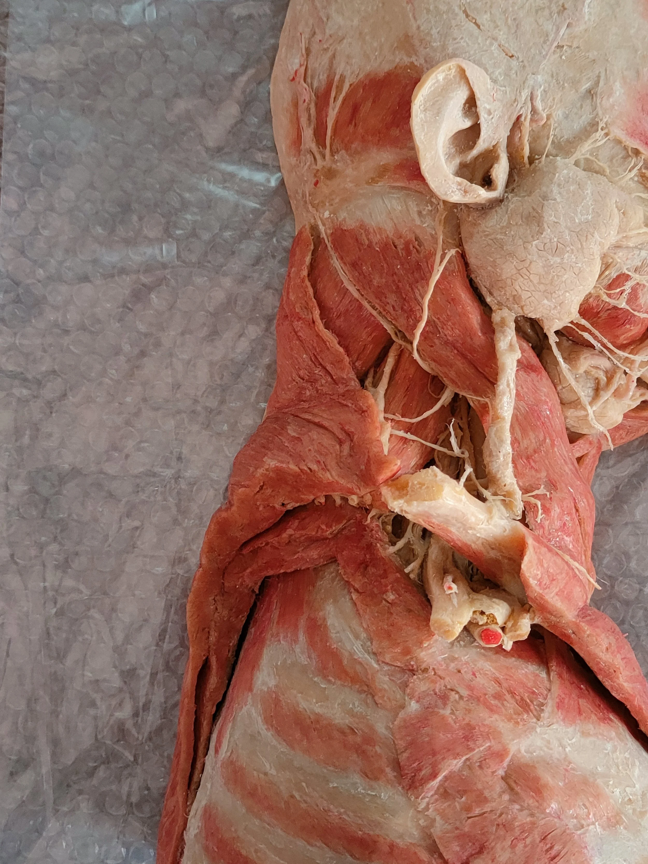 Gunther von Hagens plastinated