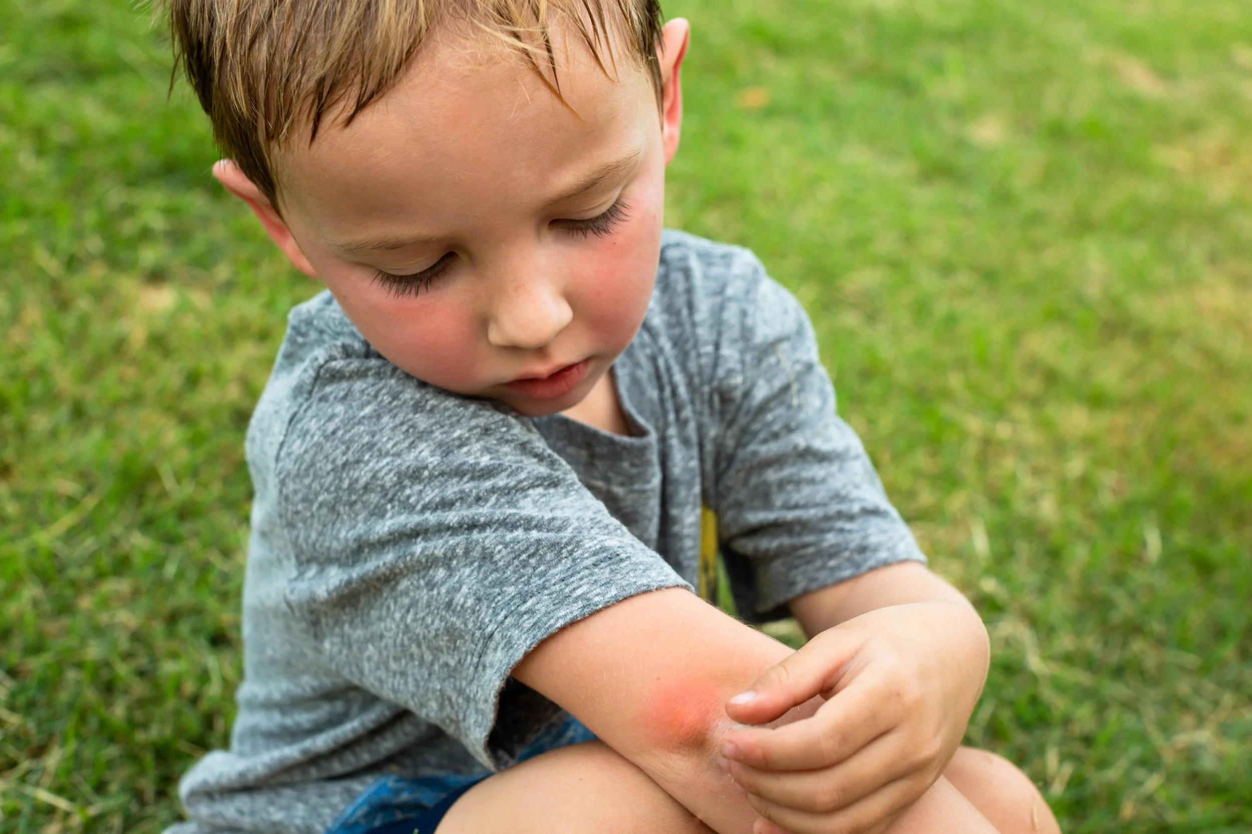 Bites, stings and poisonings