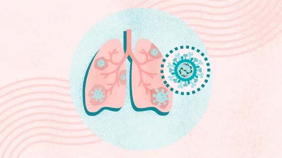 RSV Vaccine: What is RSV and Who Is Eligible?