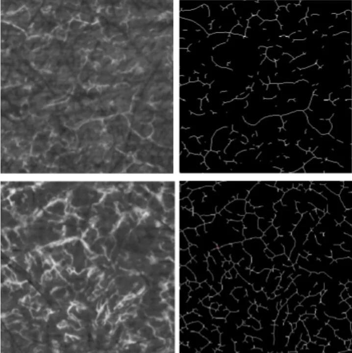 Automated analysis of blood vessel morphology using angiographic optical coherence tomography