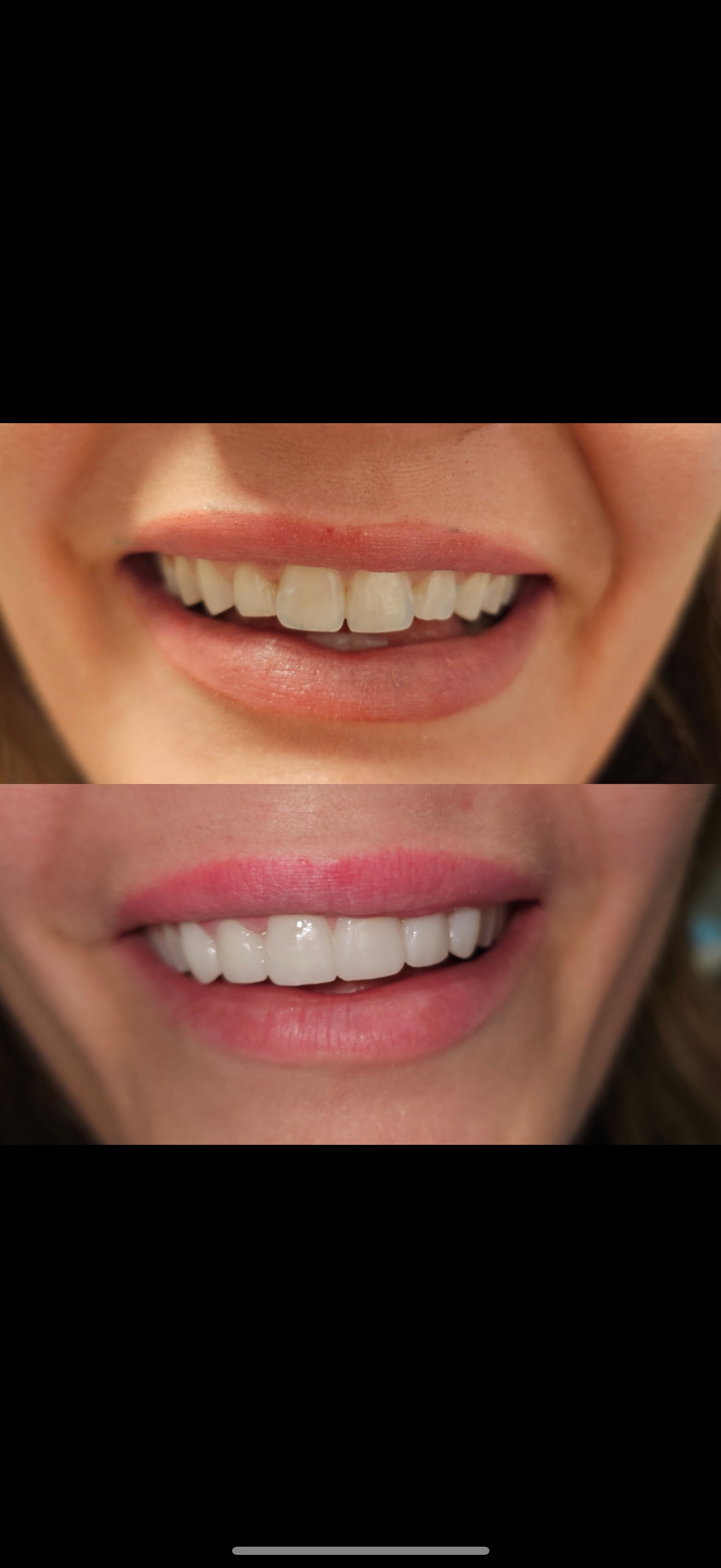 beforeafter temp.PNG