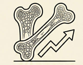 Impact on bone density as we age and risk for osteoporosis.