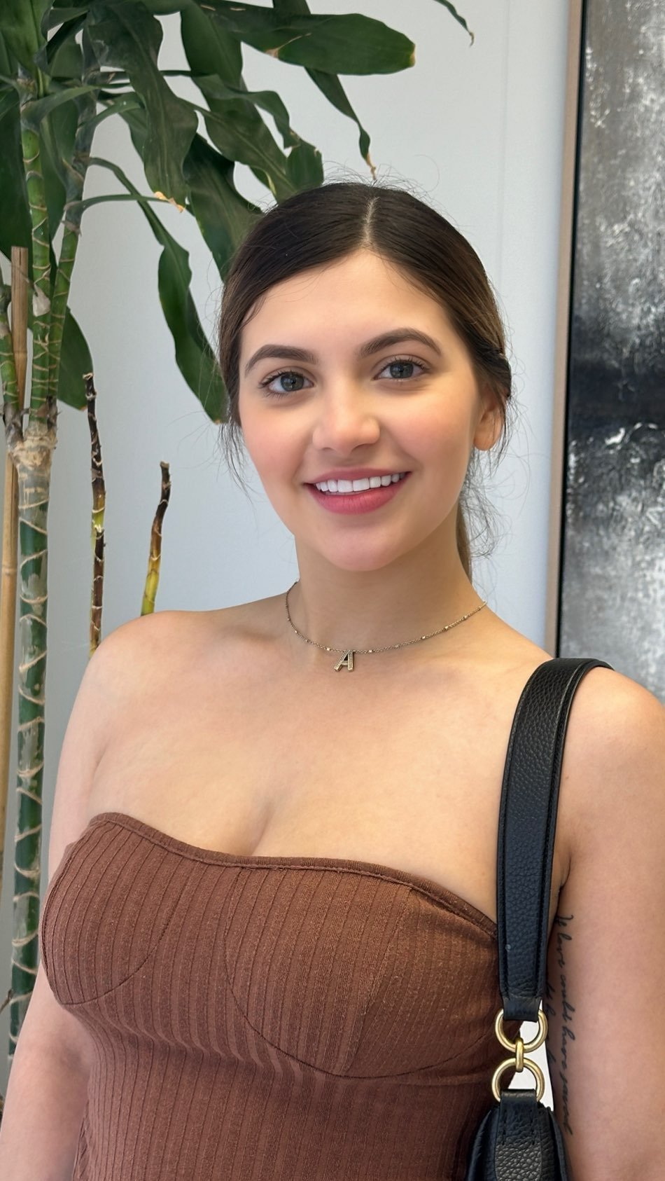 Gallery — Forever Veneers