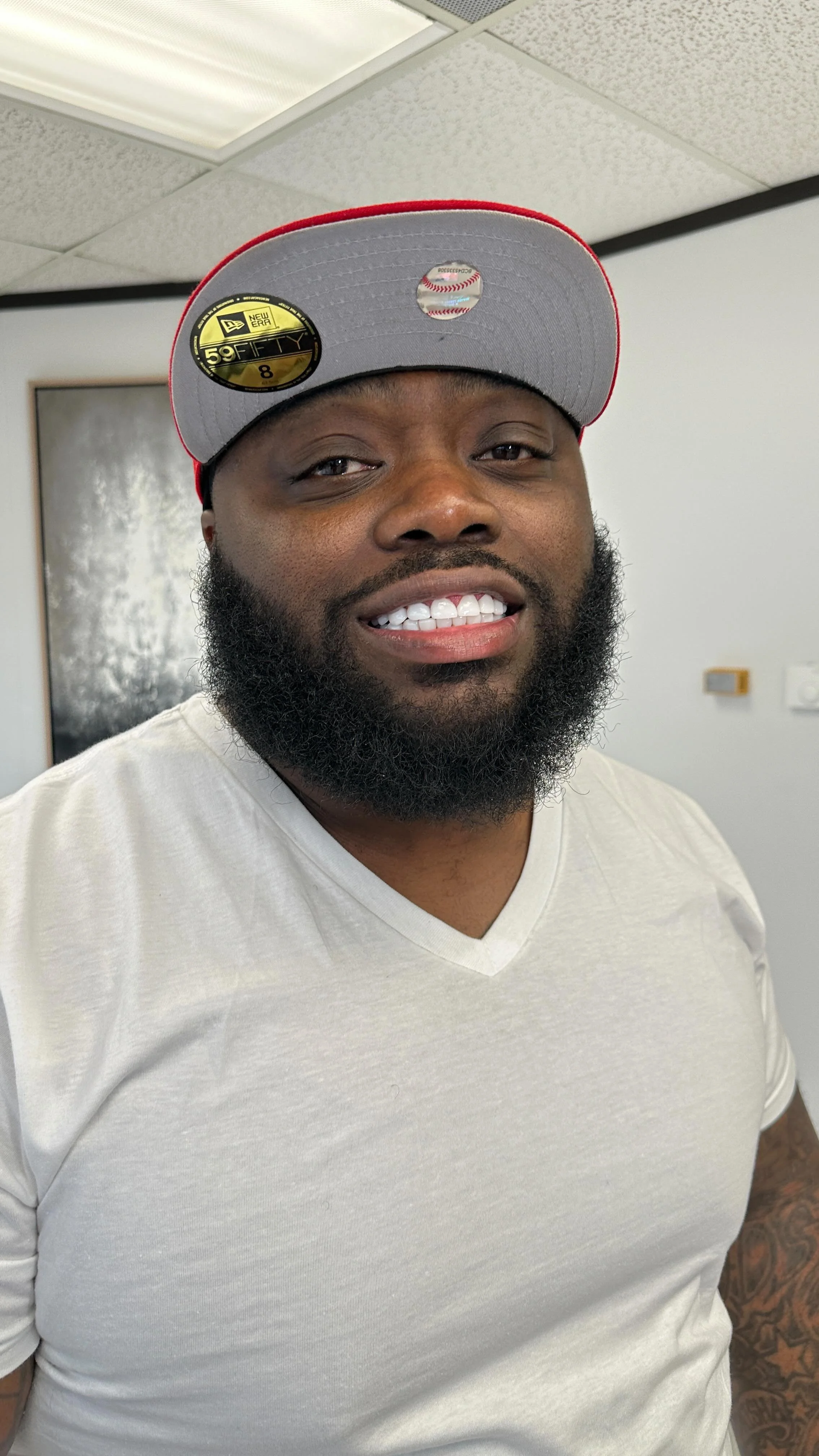 Gallery — Forever Veneers