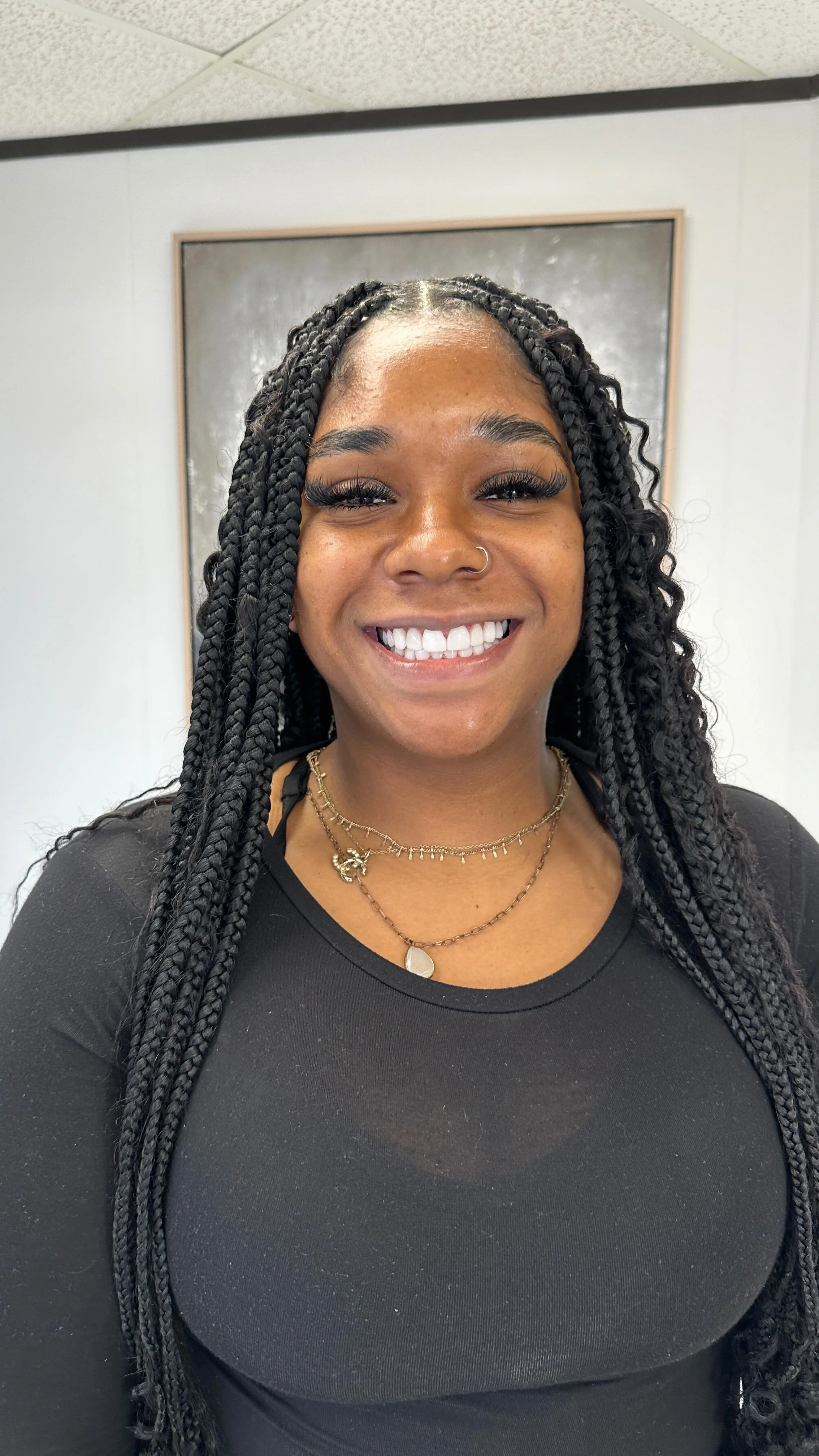 Gallery — Forever Veneers