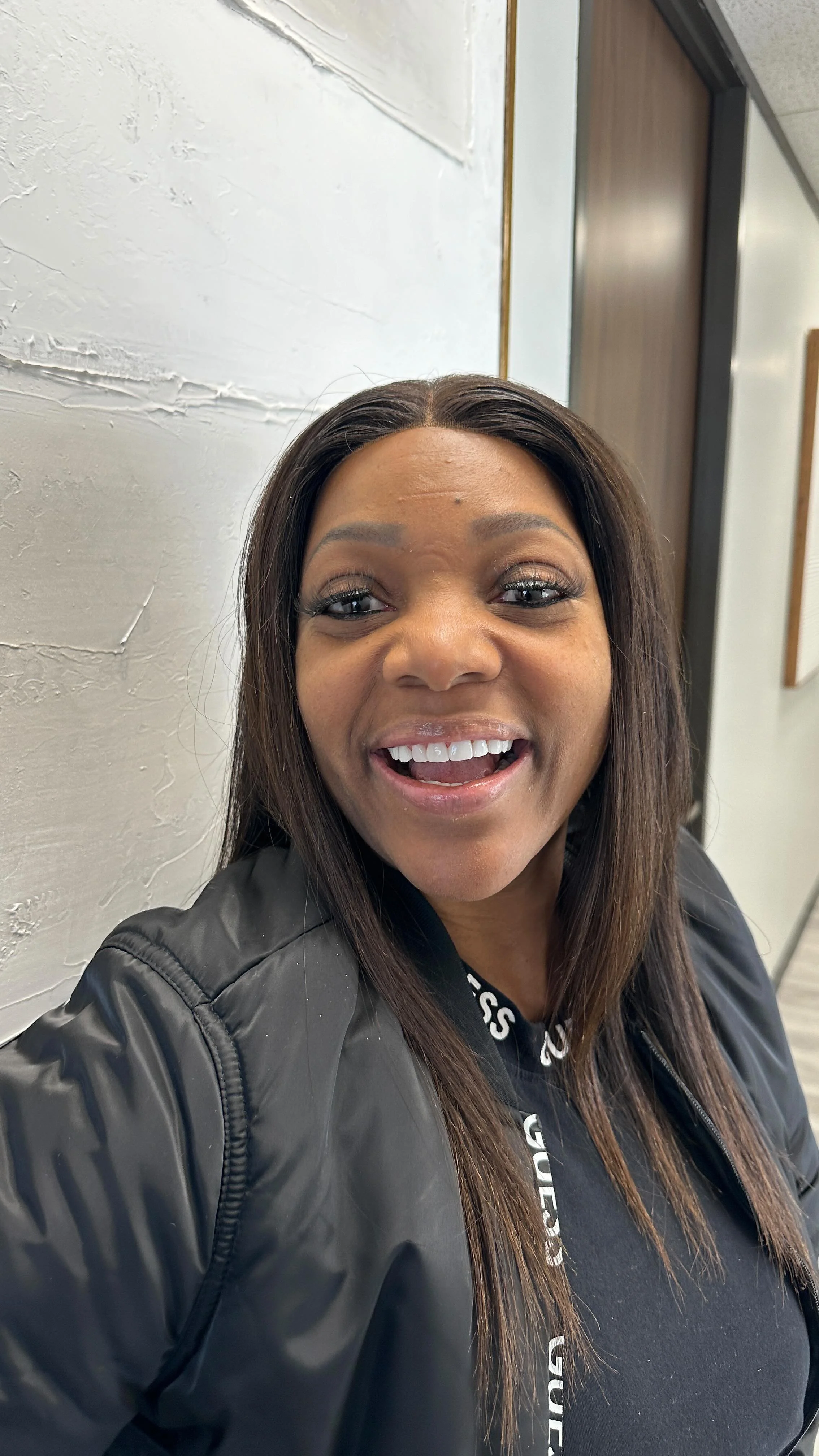 Gallery — Forever Veneers