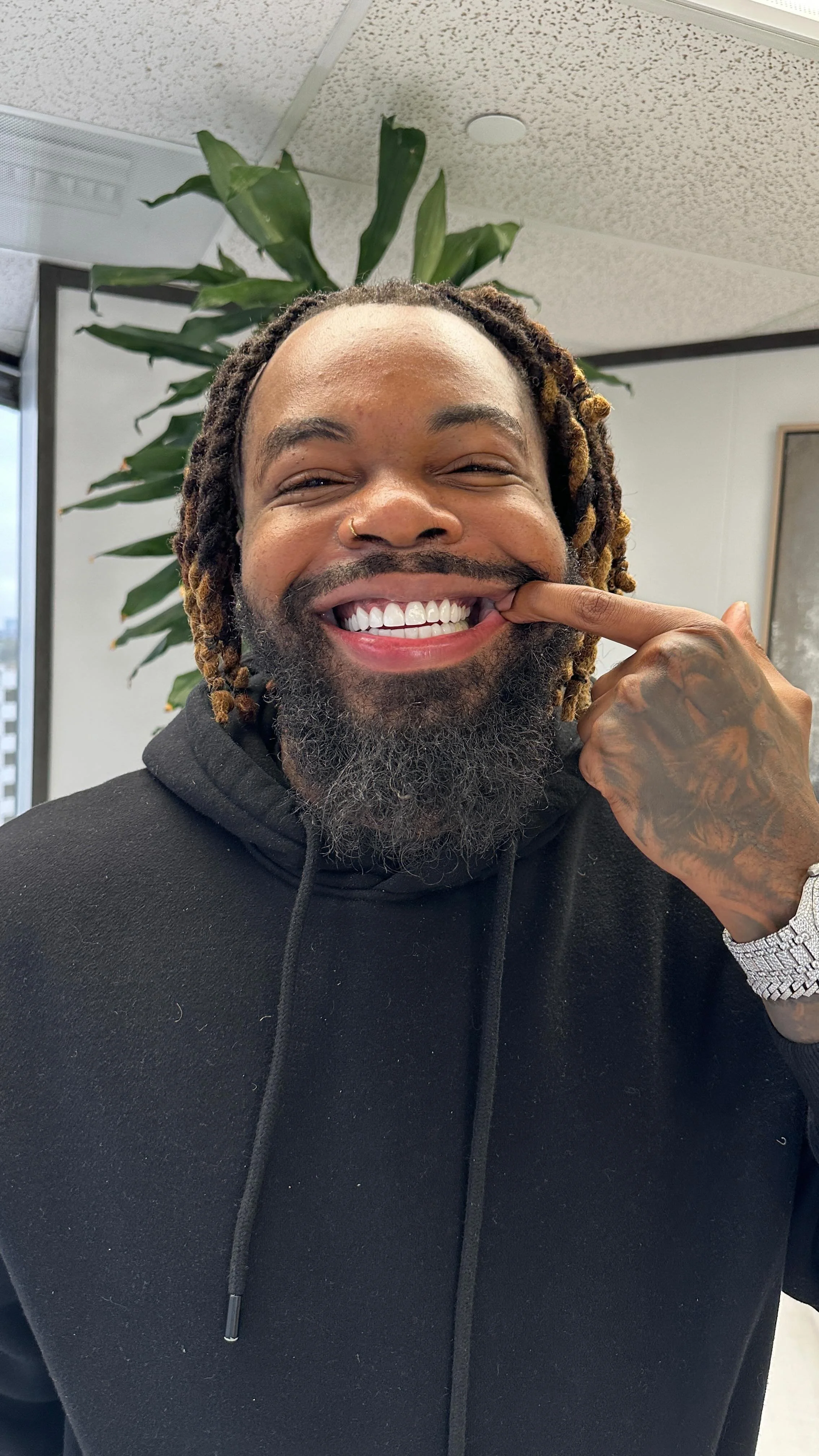 Gallery — Forever Veneers