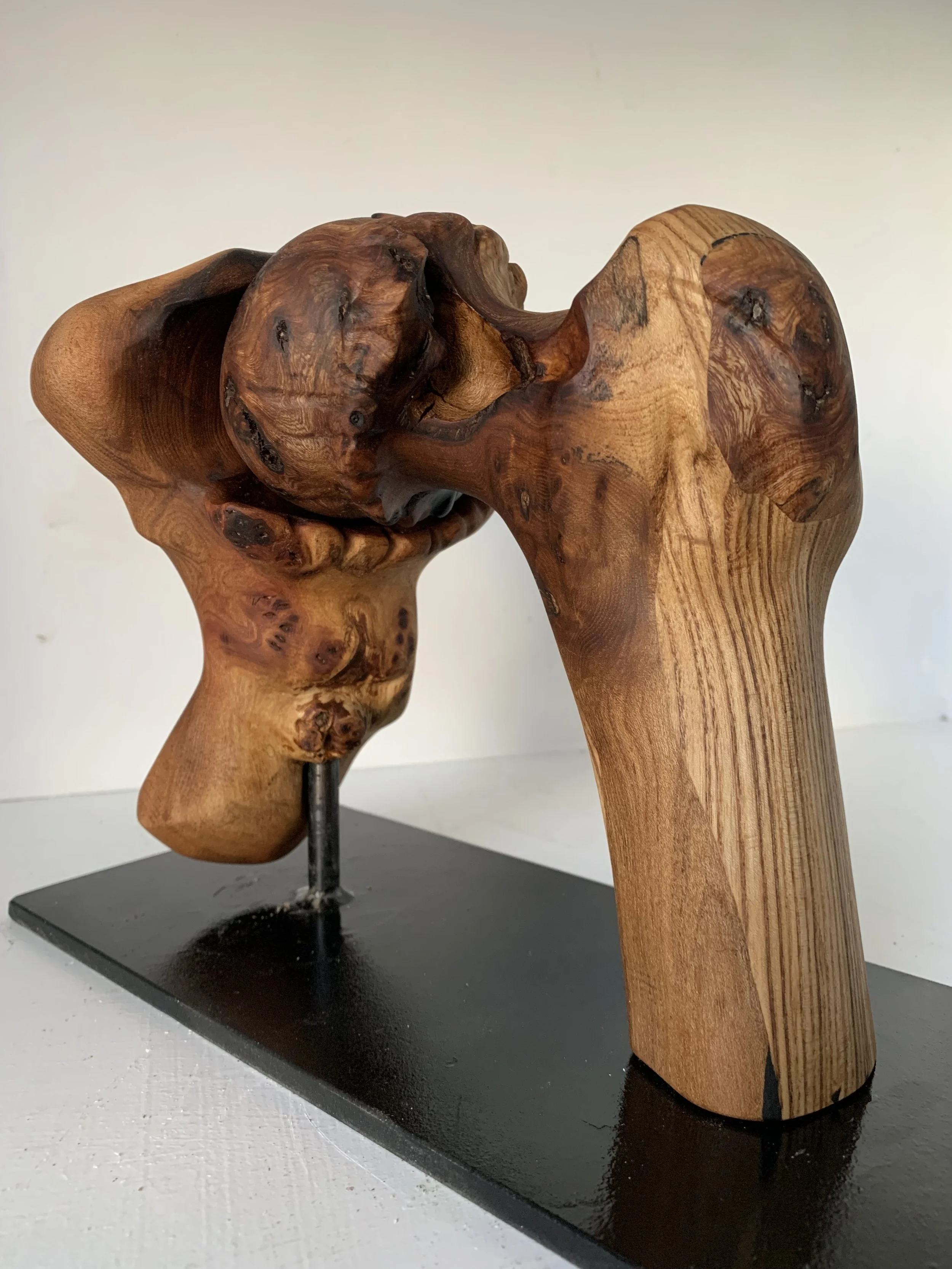 Arthritic Hip Study