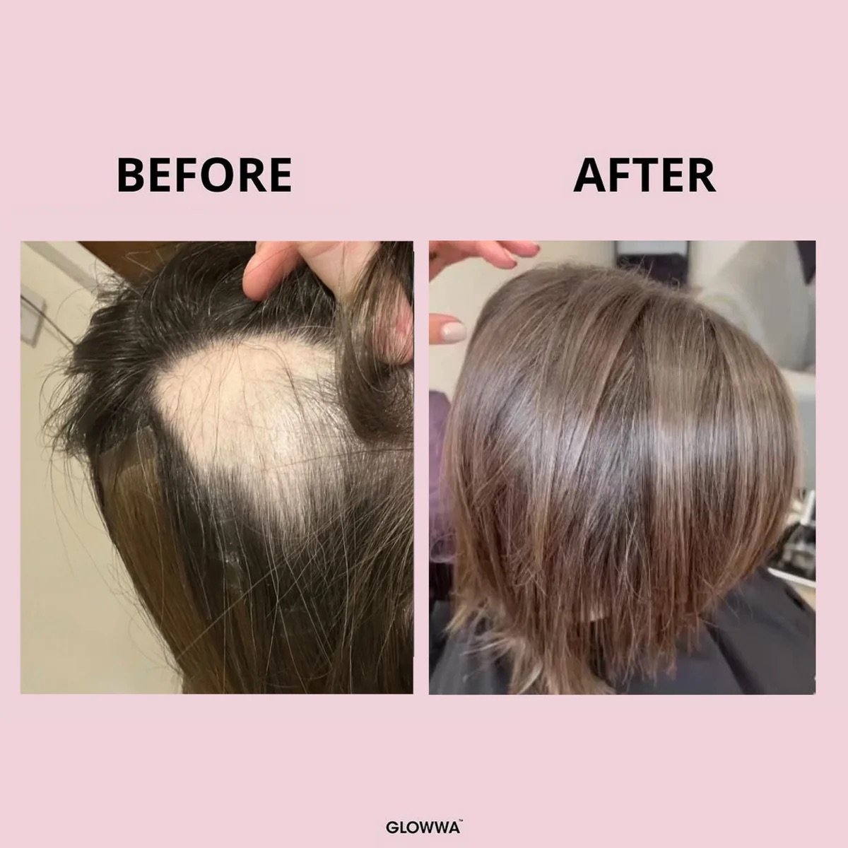 Beforeandafter glowwa.jpeg