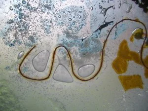 A microscopic view of a slender, elongated worm-like organism on a wet surface, with some yellow and blue material nearby.