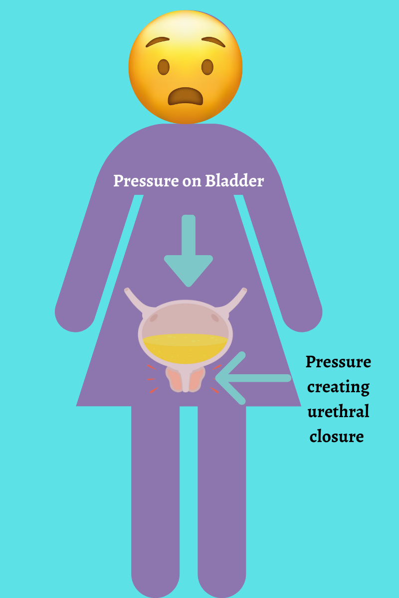 Pelvic Floor Physical Therapy and Incontinence: Does it work?