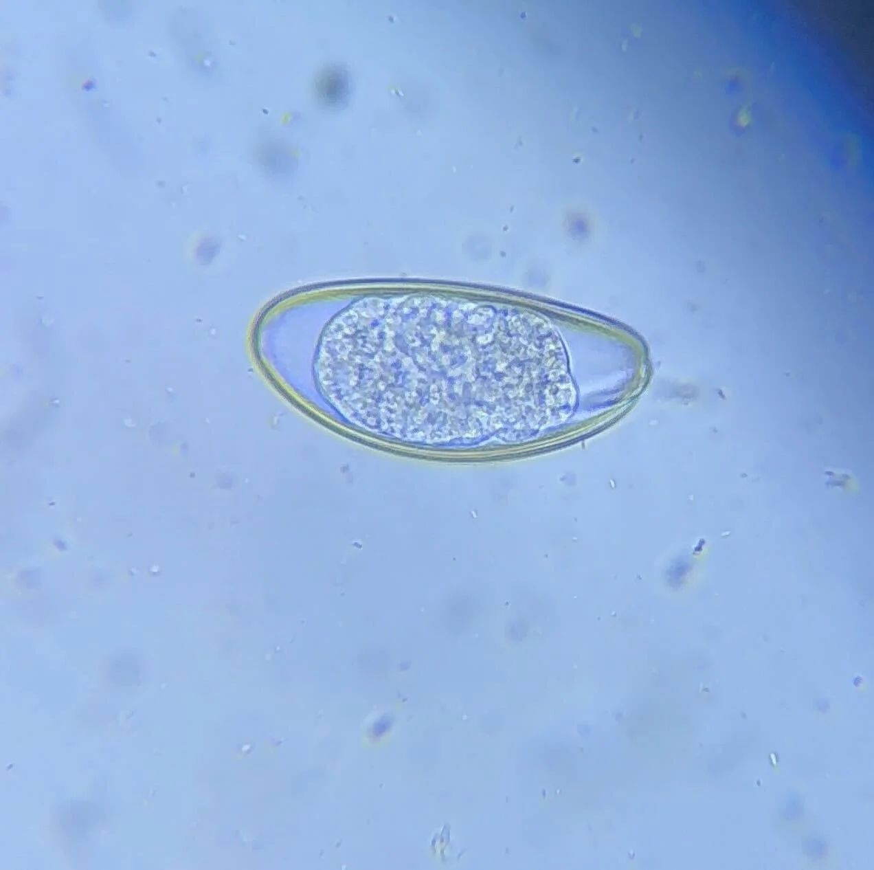 After months of care and treatment, each rabbit was cleared for adoption once their fecal floats showed no parasites, unlike these example images above.