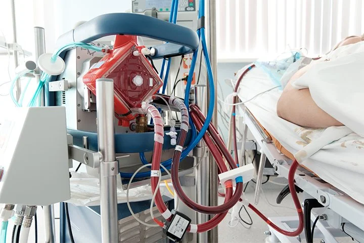 ecmo.jpg