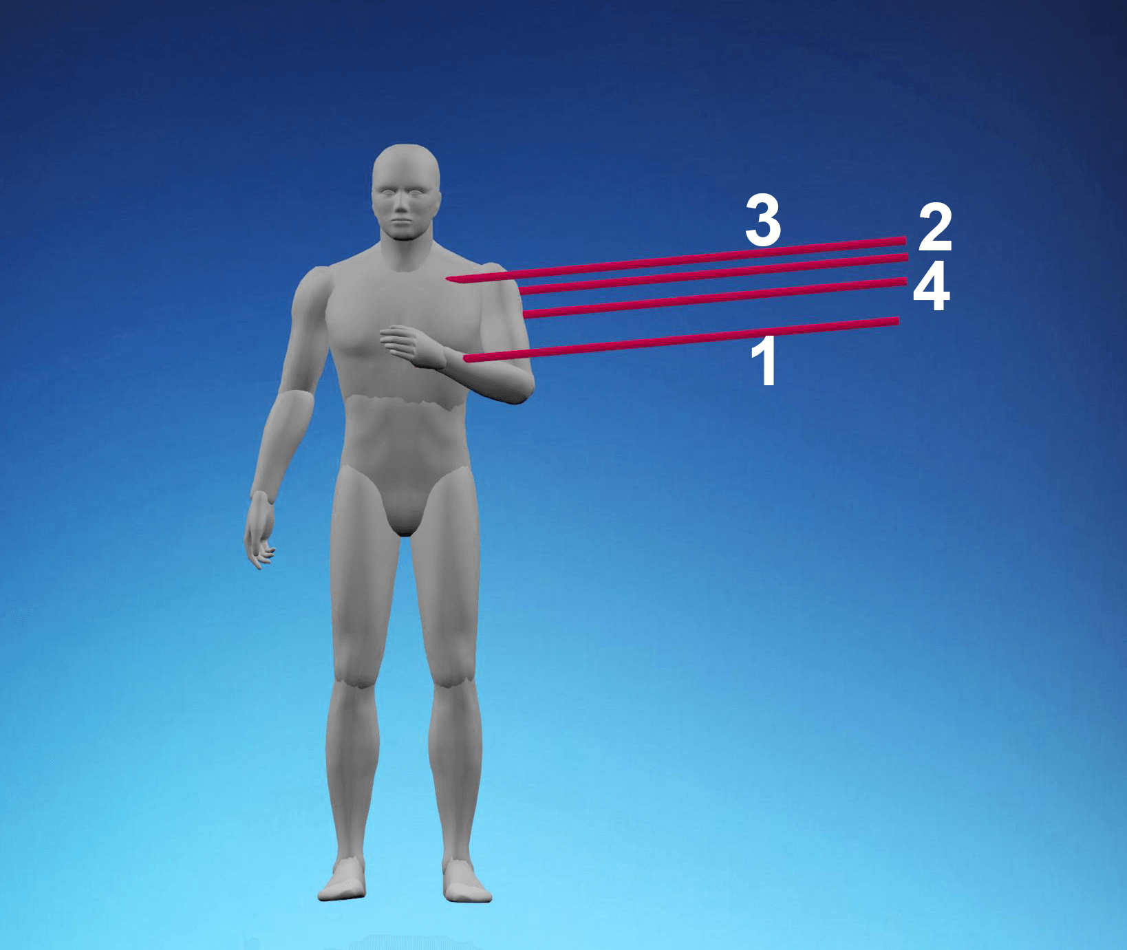 A human anatomical figure with labeled lines pointing to the chest, shoulder, and arm area.