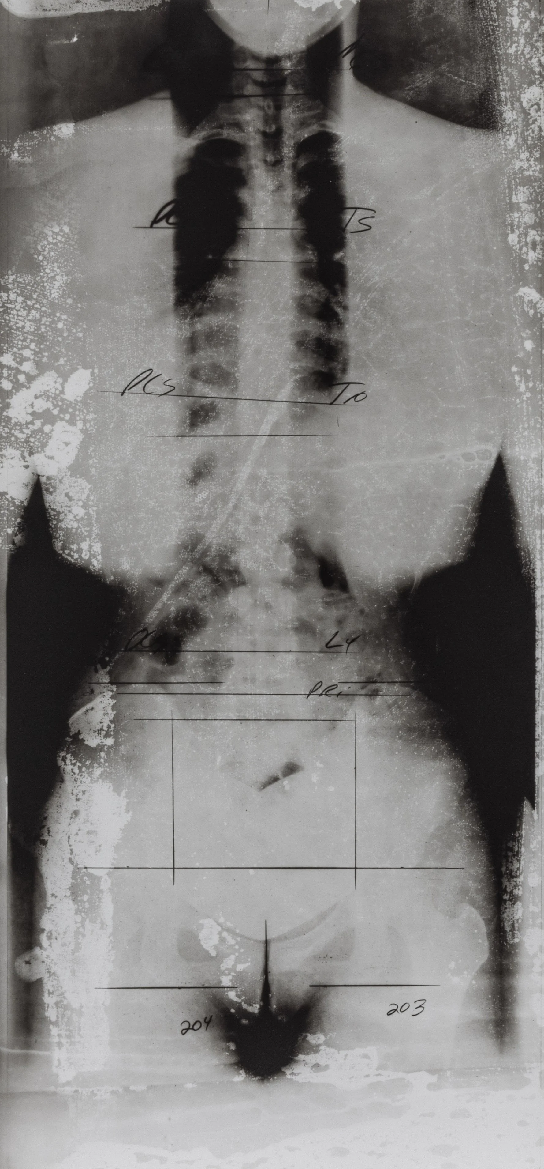 Frontal Torsos