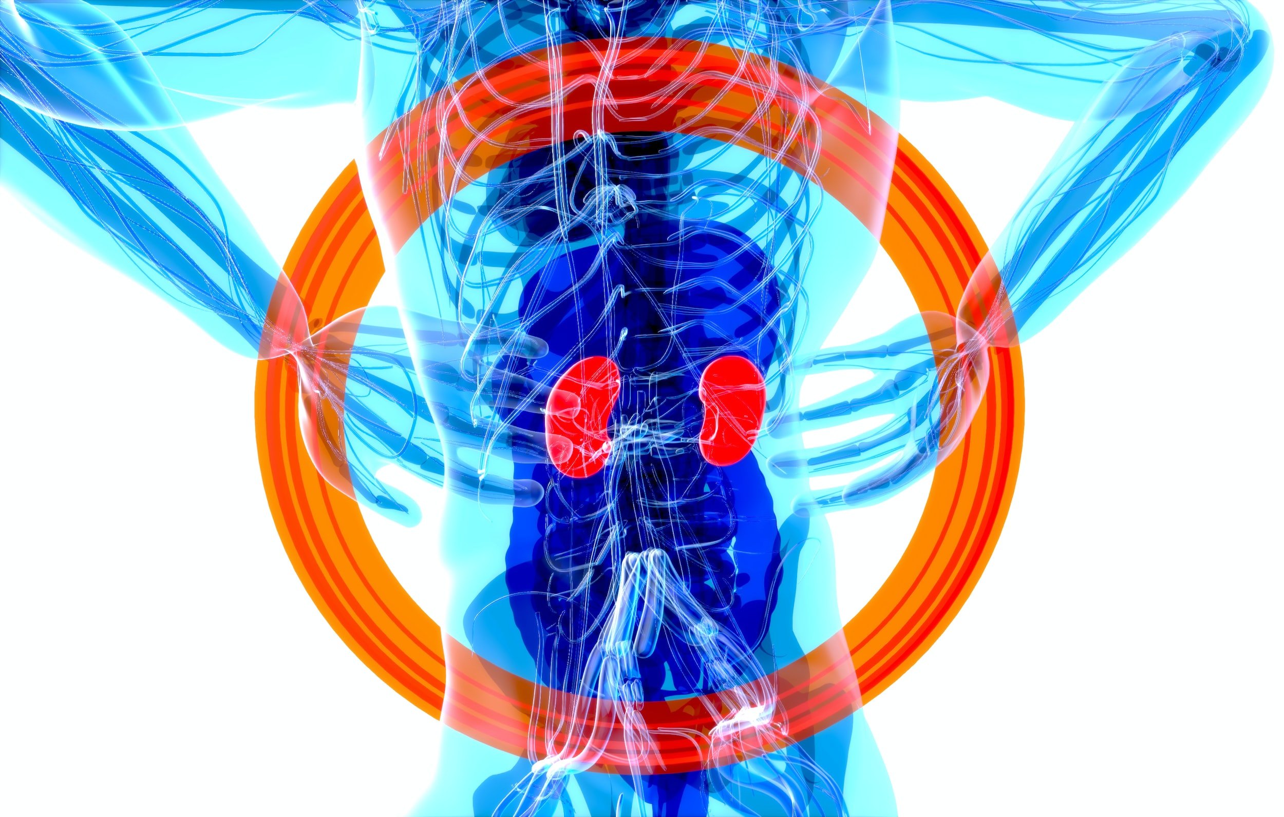 Case Study: Proton Pump Inhibitors (PPIs) and Reflux