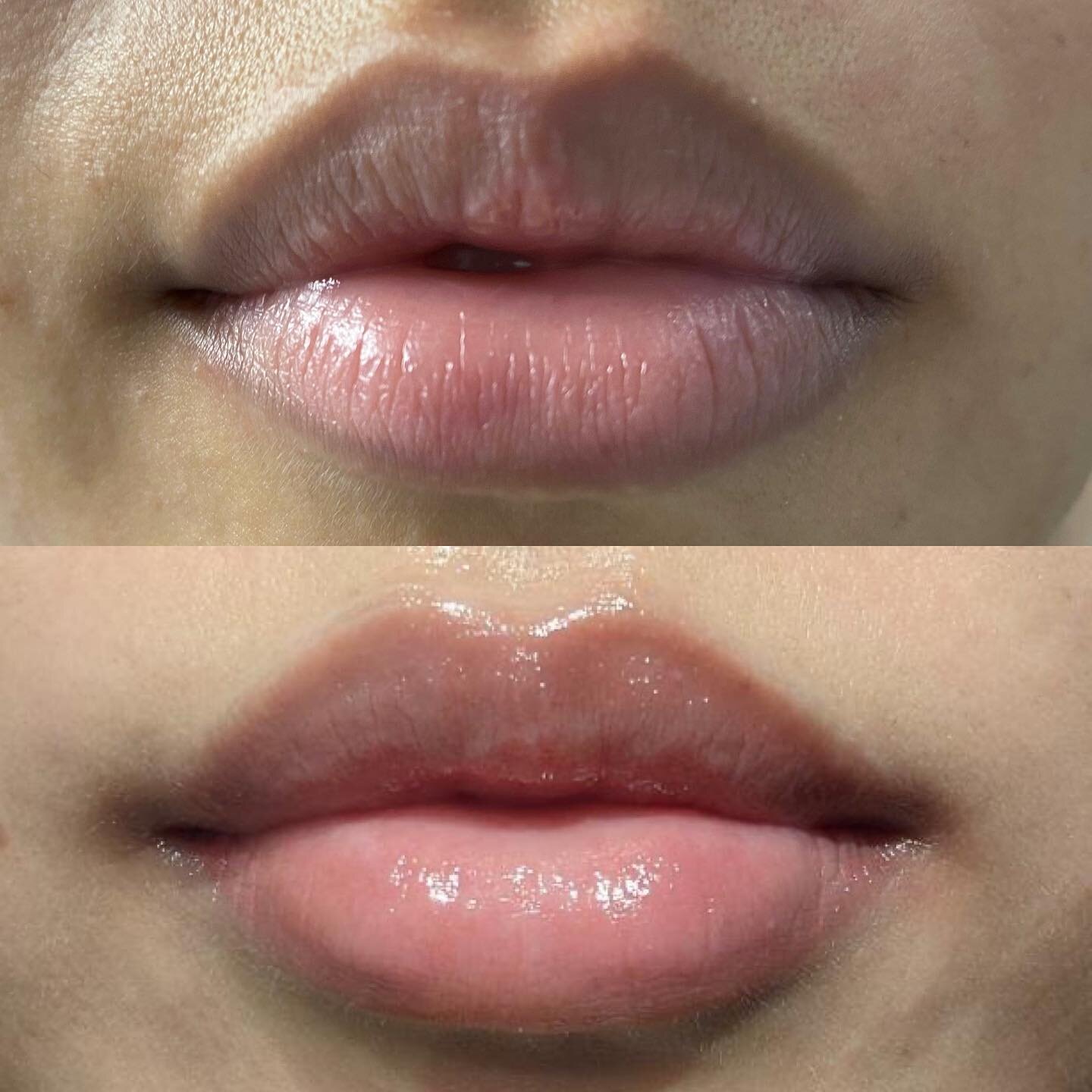 Hello everyone!

A some of you may or may not know, @torontobeautyroom is our PMU artist that specializes in Lip blush/Neutralization services!

In the photo above is a great example of what Lip neutralization can offer 👄 

If you experience dark li