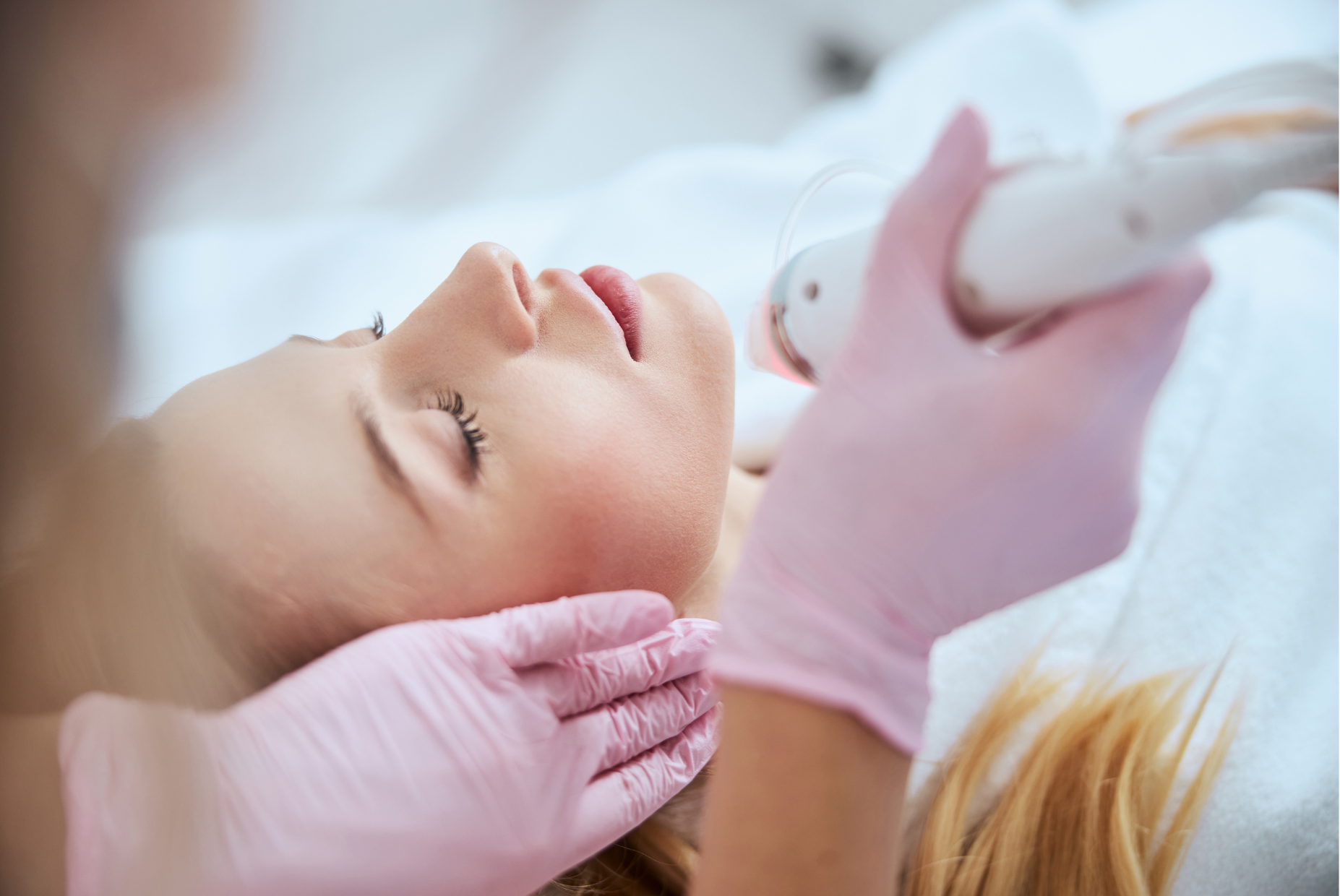 RF-Microneedling
