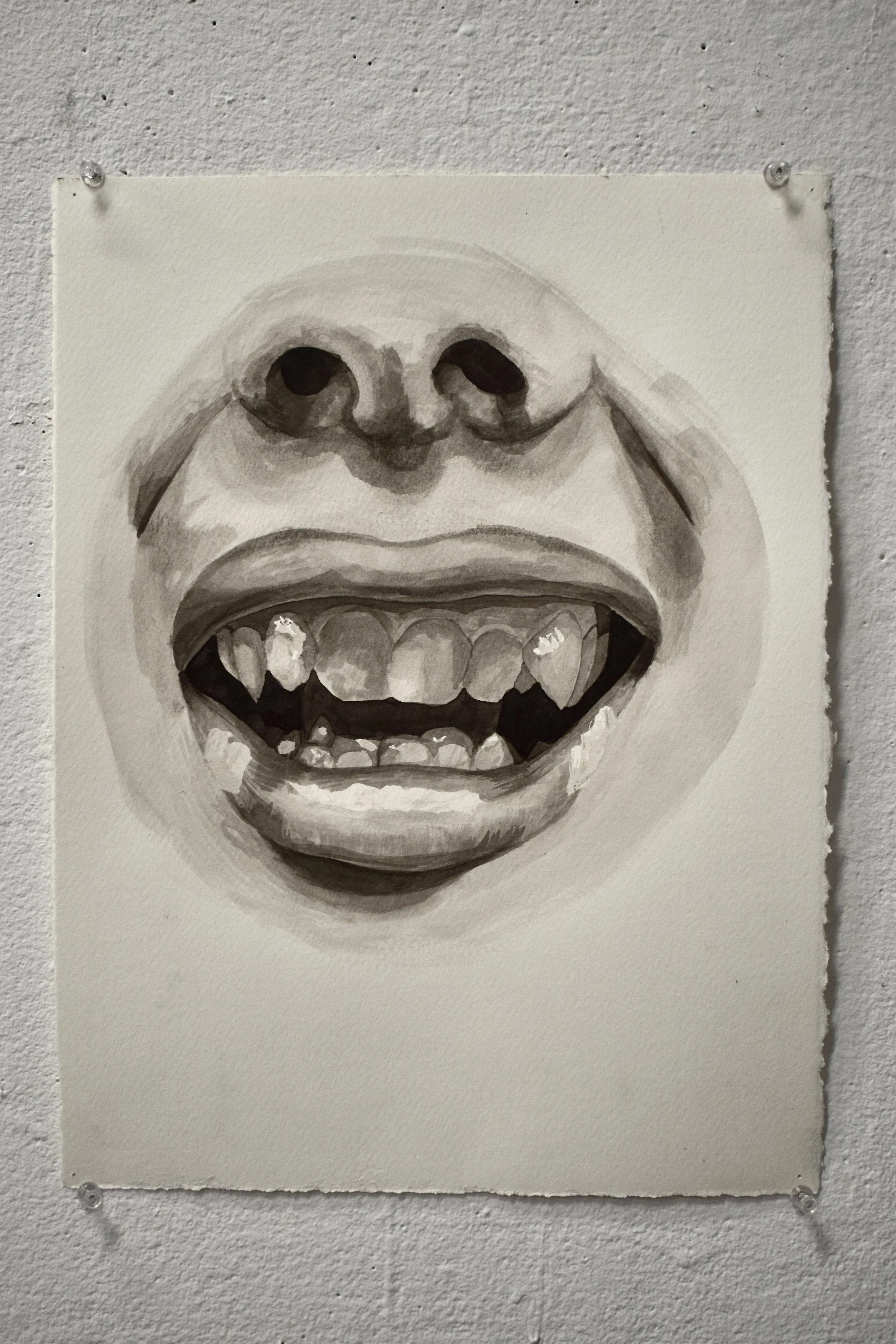 Watercolor painting of a smiling mouth with missing teeth on paper hanging on a wall.