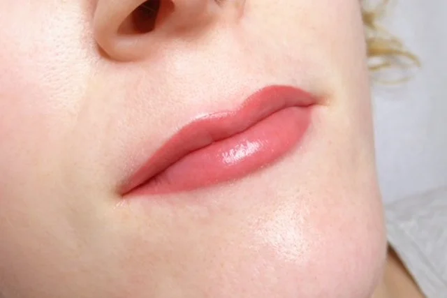 lippen-nachher.jpg