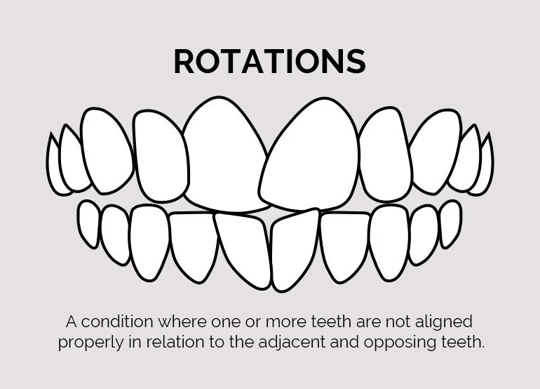 Rotations