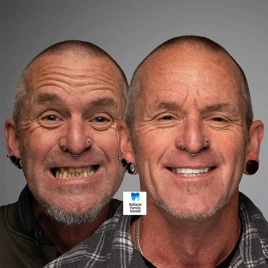 Treatment: Injectable Composite