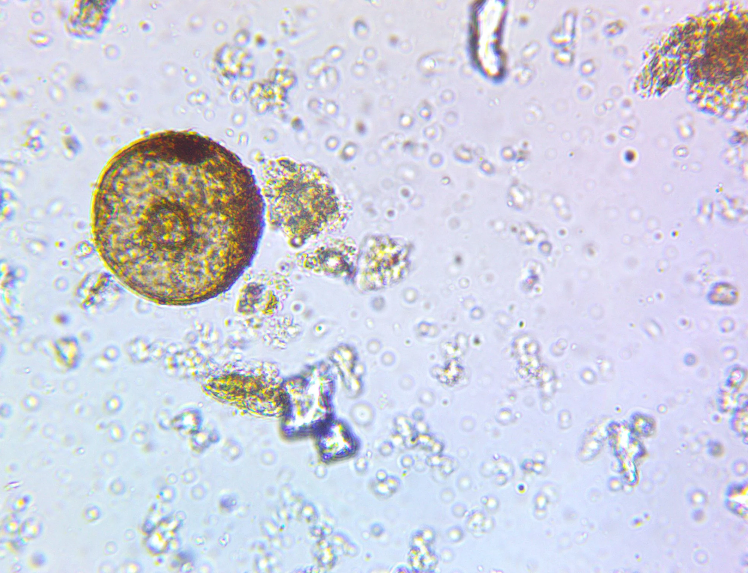 What Are Soil Microbes? Who Are They and What Do They Do?