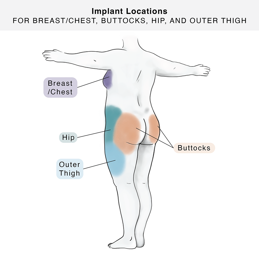 medical illustration Gender Confirmation Center