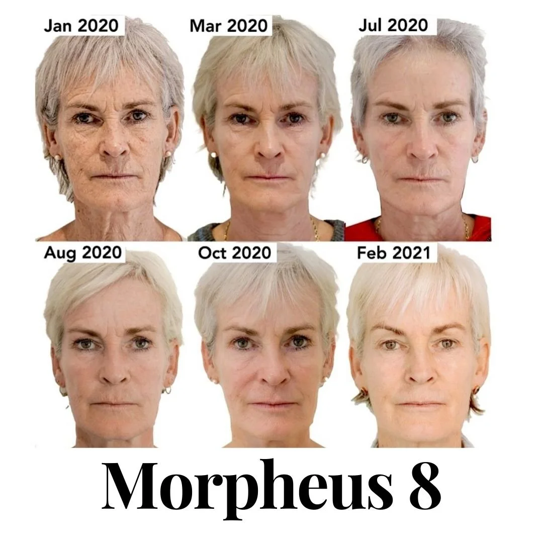 Morpheus-8-5 (1).jpg