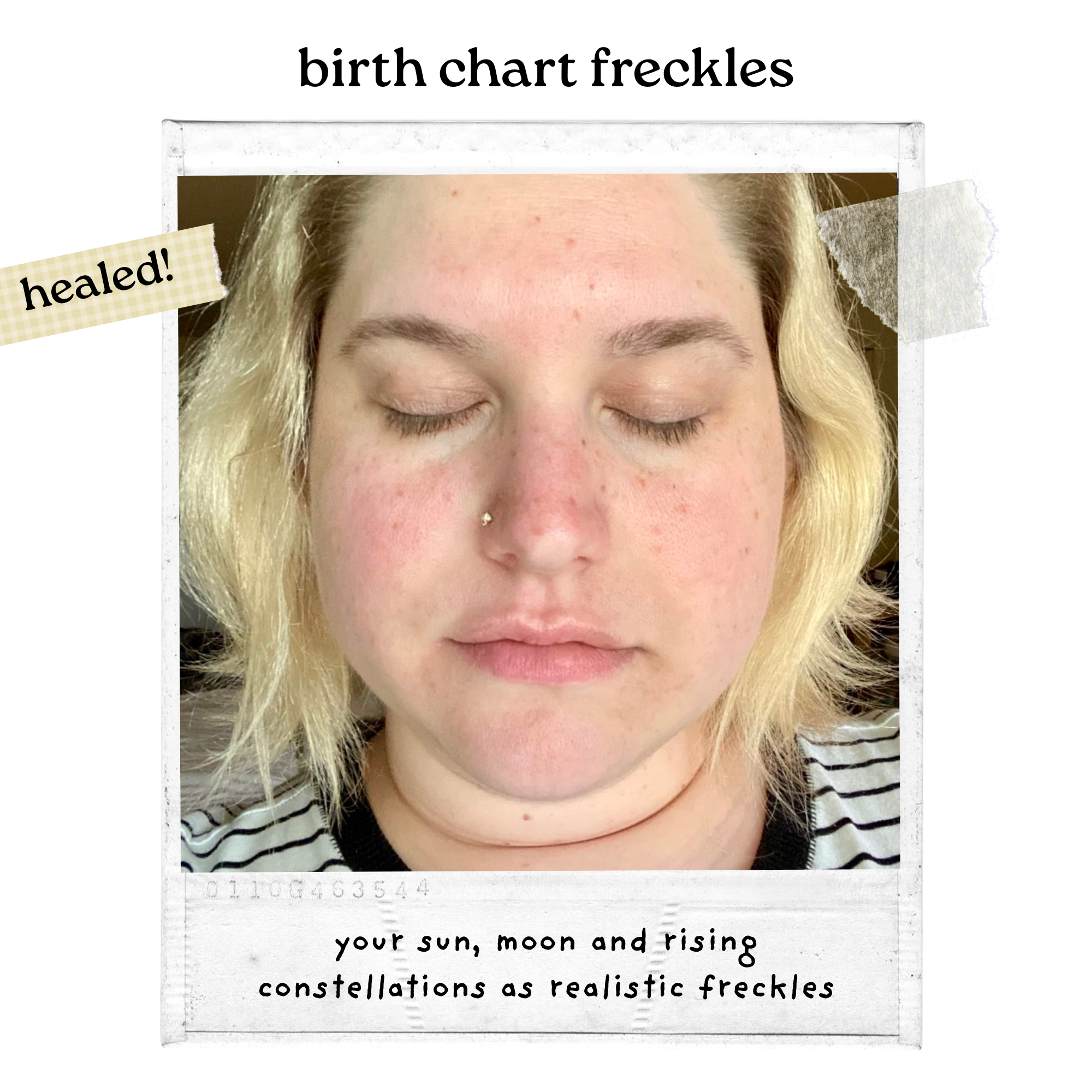 Birth chart freckles