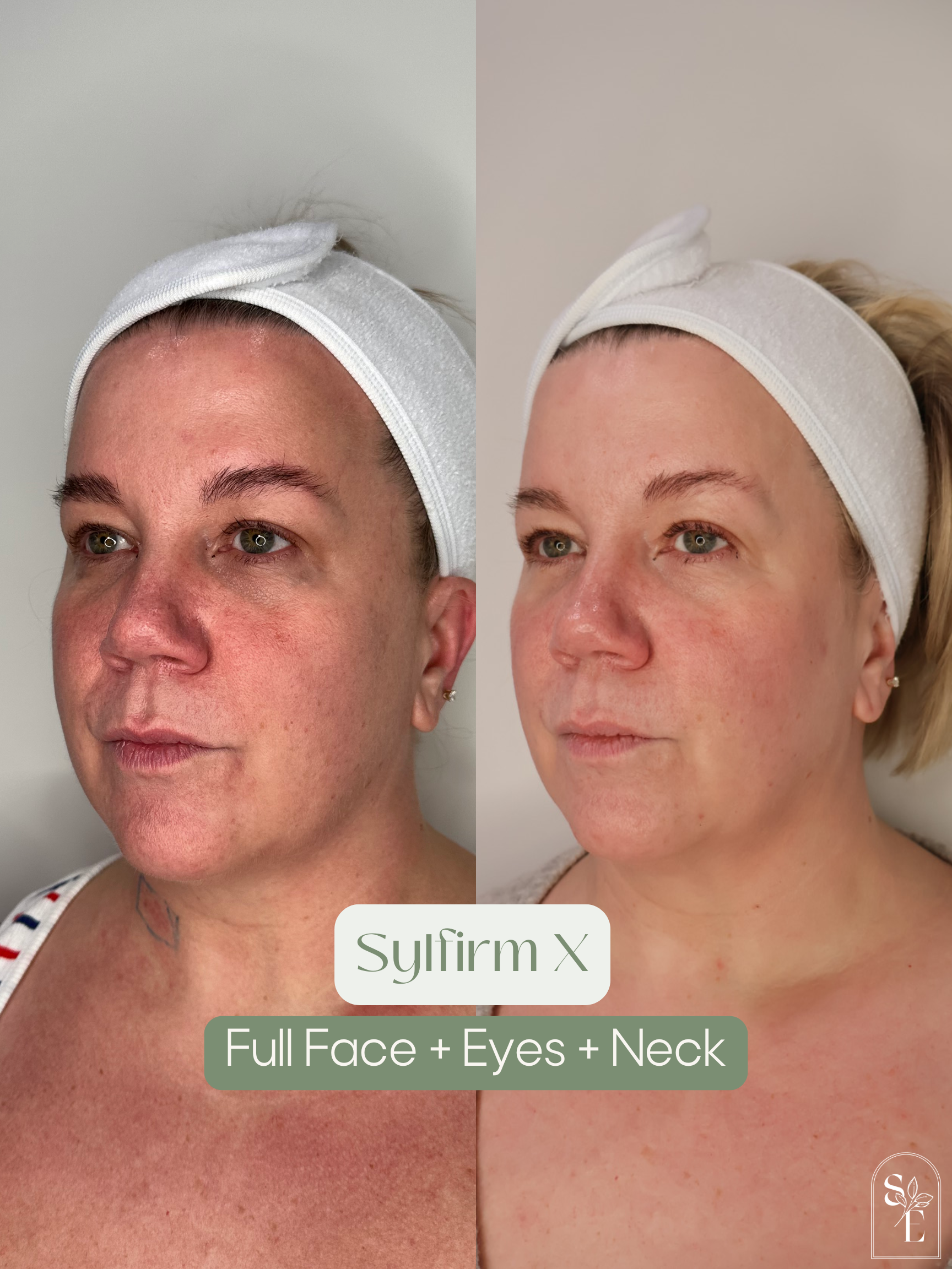 before & after (IG + GMB) (22).png