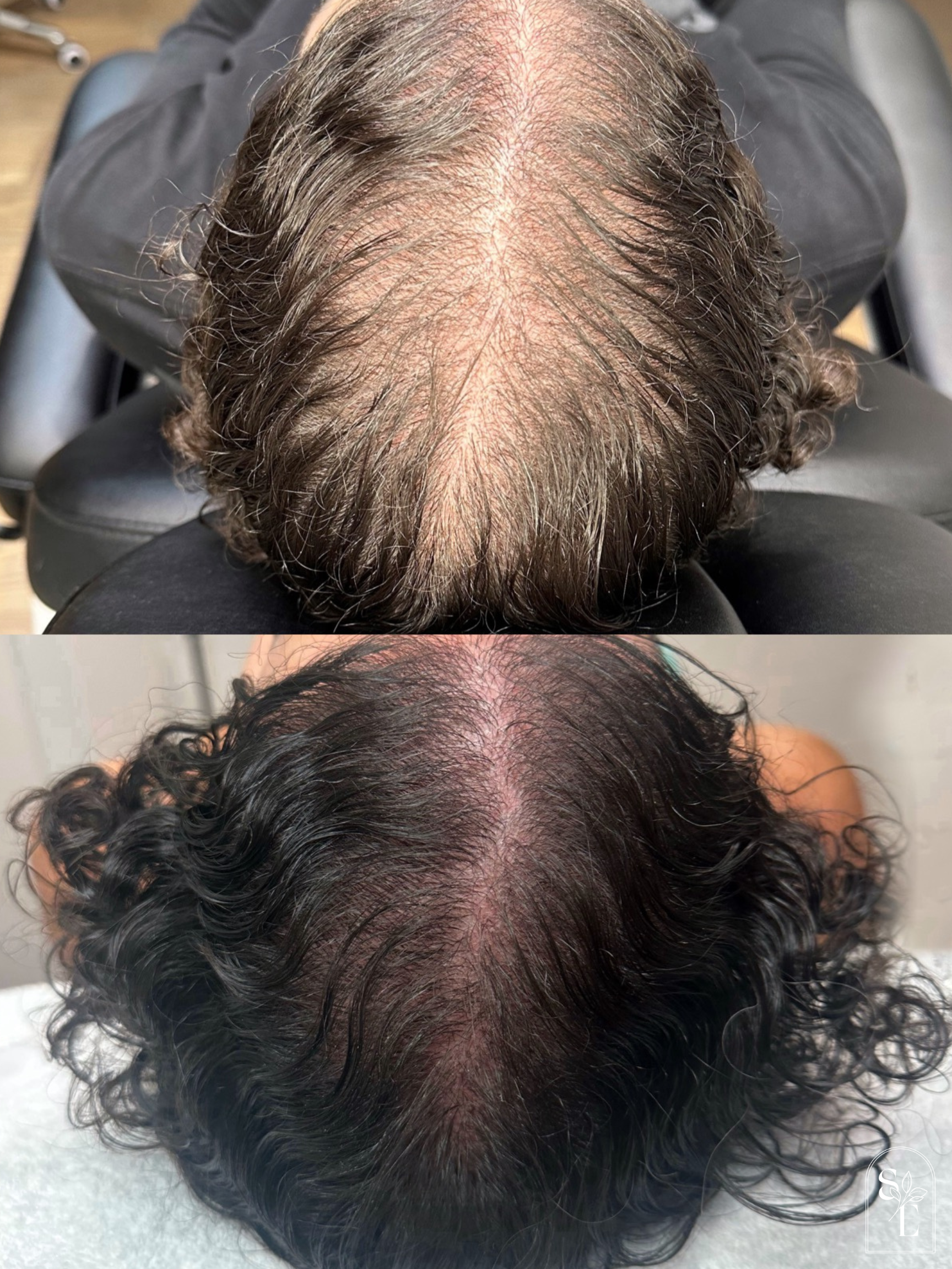 before & after (IG + GMB)-4.png