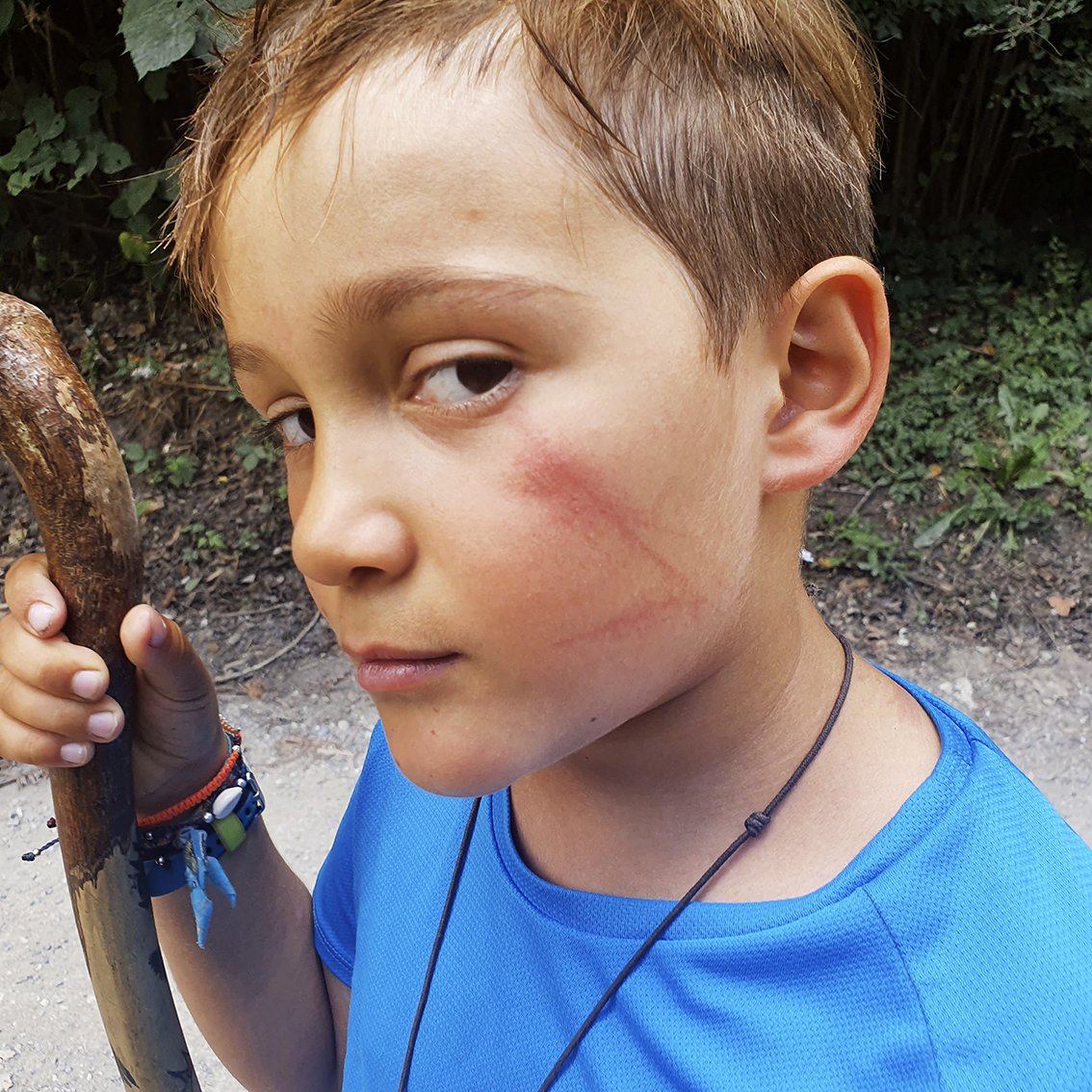 A boy with short brown hair, wearing a blue T-shirt, holding a wooden stick and presenting a neutral expression. He has a red wound on his cheek and wears a colorful bracelet on his wrist, with a background of vegetation.