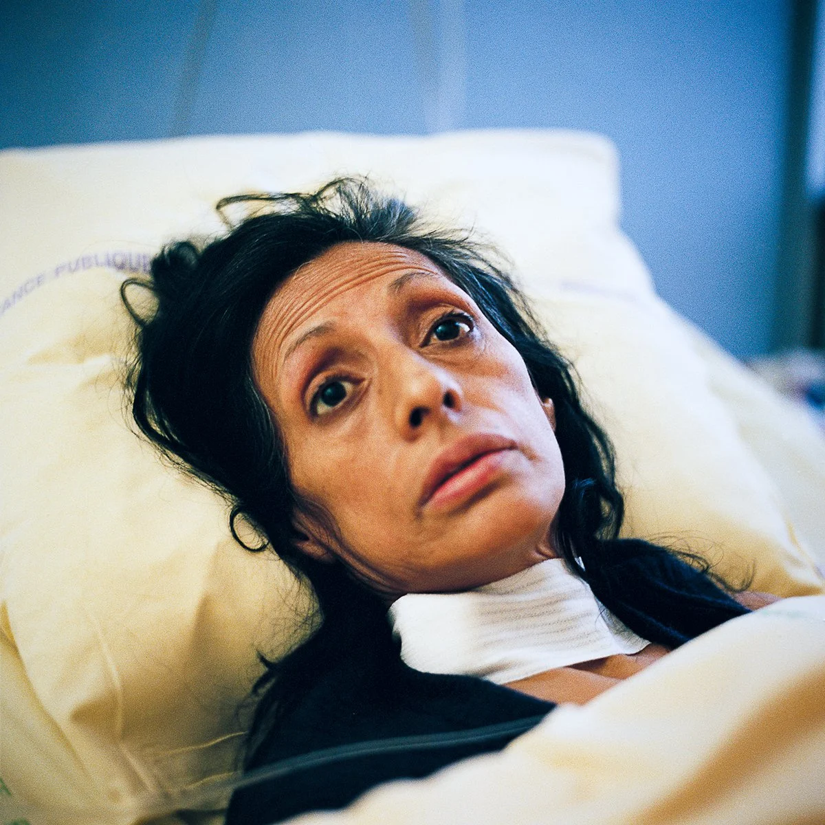 Une femme allongée dans un lit d'hôpital, regardant vers l'objectif, avec un visage fatigué et une expression pensive.