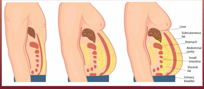 Boston Guide: The Most Dangerous Fat You Can’t See